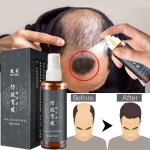 50ml - srum de croissance capillaire rapide pour hommes et femmes traitement anti - chute perte de cheveux ...