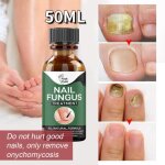 50ml - sérumessence antifongique pour les ongles produit anti infection réparation des pieds élimination ... 50ml - sérumessence antifongique pour les ongles produit anti infection réparation des pieds élimination ...