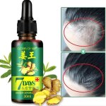 Anti chute cheveux srum de croissance des cheveux naturel  base de plantes srum de pousse cheveux ...