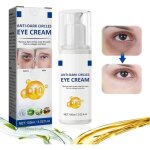 Anticerne - crme contour des yeux - rduit les cernes - hydratant - anti - ge - collagne et aloe vera ...