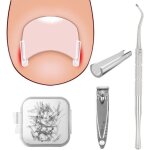 Bandes de redressement sans douleur kit de correction pour ongles incarn�s levier pour ongles - soulagement ...