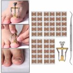 Correcteur dongle incarn patch de correction dongle de pdicure autocollant outil de soins des pieds ...