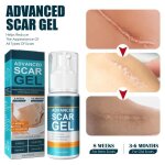 Crème cicatricielle crème anti - cicatrices gel réparateur pour les cicatrices de la peau douce et non ... Crème cicatricielle crème anti - cicatrices gel réparateur pour les cicatrices de la peau douce et non ...