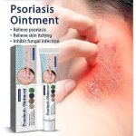 Cr�me de psoriasis - marque - traitement naturel - 20g - soulagement rapide - extraits de plantes