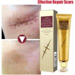 Crème réparatrice - creme reparatrice - 30g - Élimine cicatrices - corrige pigmentation - pour bébé Crème réparatrice - creme reparatrice - 30g - Élimine cicatrices - corrige pigmentation - pour bébé