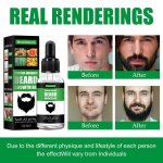 Huile essentielle naturelle pour la croissance de la barbe - 30ml baume à cire pour hommes sérum anti ... Huile essentielle naturelle pour la croissance de la barbe - 30ml baume à cire pour hommes sérum anti ...