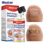 Ibealee traitement des champignons des ongles 7 jours essence srum huile de soin soins des mains et ...
