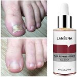 Traitement des ongles antifongiques avec essence de rparation des ongles lanbena