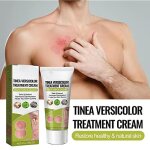 Vernis � ongles - traitement antifongique - tinea versicolor - pied d?athl�te - 1 pcs