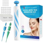 Acrochordons traitement kit dlimination acrochordons skin tag remover 2 - 8mm quipement de suppression ...
