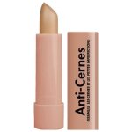 Anti cernes miss europe