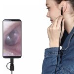 Endoscope de cuillère doreille otoscope de nettoyage doreille de caméra dendoscope hd usb de cuillère ... Endoscope de cuillère doreille otoscope de nettoyage doreille de caméra dendoscope hd usb de cuillère ...
