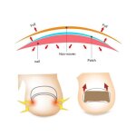 Omabeta patch pour ongles incarns patch correcteur dongles incarns outils de pdicure hygiene manucure ...