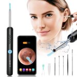 Otoscope oreillespecool endoscope oreille1080p camera oreille6 lumières ledconvient aux smartphones tels ... Otoscope oreillespecool endoscope oreille1080p camera oreille6 lumières ledconvient aux smartphones tels ...