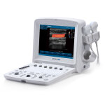 Echographe u50 avec 1 sonde edan Echographe u50 avec 1 sonde edan