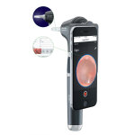 Otoscope macroview 2 plus iexaminer Otoscope macroview 2 plus iexaminer