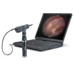 Otoscope macroview digital