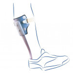 Thuasne peromed adapt releveur de pied droite taille m blanc
